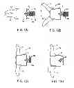 Fig. 20 - Interspinous spacer