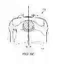Fig. 12 - Multi-axial spinal cross connecting device