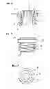 Fig. 04 - Bone anchoring device