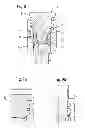 Fig. 06 - Bone anchoring device