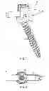 Fig. 02 - Extended tab bone screw system