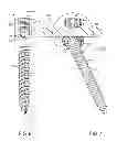 Fig. 05 - Extended tab bone screw system