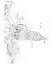 Fig. 08 - Plate/screw locking mechanism devices, systems and methods