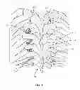 Fig. 02 - System and method for correction of a spinal disorder