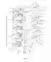 Fig. 08 - System and method for correction of a spinal disorder