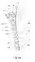 Fig. 28 - Systems and methods for using polyaxial plates