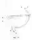 Fig. 07 - IMPLANT MODULE AND METHOD FOR REPAIRING AVULSION FRACTURE