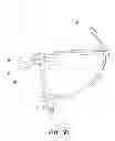 Fig. 08 - IMPLANT MODULE AND METHOD FOR REPAIRING AVULSION FRACTURE