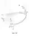 Fig. 09 - IMPLANT MODULE AND METHOD FOR REPAIRING AVULSION FRACTURE