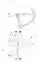 Fig. 12 - IMPLANT MODULE AND METHOD FOR REPAIRING AVULSION FRACTURE