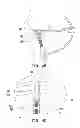 Fig. 15 - IMPLANT MODULE AND METHOD FOR REPAIRING AVULSION FRACTURE