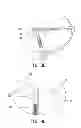 Fig. 16 - IMPLANT MODULE AND METHOD FOR REPAIRING AVULSION FRACTURE