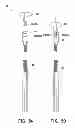 Fig. 17 - IMPLANT MODULE AND METHOD FOR REPAIRING AVULSION FRACTURE