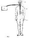 Fig. 02 - SYSTEM FOR CONTROLLING THE TEMPERATURE OF A PERSON