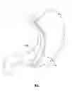 Fig. 06 - SYSTEM FOR CONTROLLING THE TEMPERATURE OF A PERSON