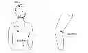 Fig. 01 - Heat Patch for Cardiovascular Diseases