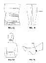Fig. 02 - HEAT PATCH FOR TUMOR