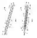Fig. 03 - IMPLANTABLE PADDLE LEAD COMPRISING COMPRESSIVE LONGITUDINAL MEMBERS FOR SUPPORTING ELECTRODES AND METHOD OF FABRICATION