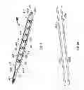 Fig. 04 - IMPLANTABLE PADDLE LEAD COMPRISING COMPRESSIVE LONGITUDINAL MEMBERS FOR SUPPORTING ELECTRODES AND METHOD OF FABRICATION