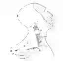 Fig. 01 - NEURAL STIMULATION DEVICE WITH INSULATING SHEATH