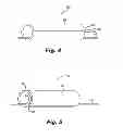 Fig. 05 - NEURAL STIMULATION DEVICE WITH INSULATING SHEATH