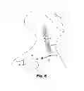 Fig. 06 - NEURAL STIMULATION DEVICE WITH INSULATING SHEATH