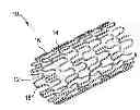Fig. 01 - TiNCmodified surface for an implantable device and a method of producing the same