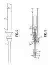 Fig. 03 - System and method for delivering and deploying an occluding device within a vessel
