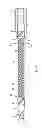 Fig. 08 - System and method for delivering and deploying an occluding device within a vessel