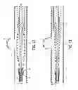Fig. 11 - System and method for delivering and deploying an occluding device within a vessel