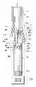 Fig. 01 - OVER-THE-WIRE INTERLOCK ATTACHMENT/DETACHMENT MECHANISM