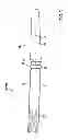 Fig. 04 - Medical Implant
