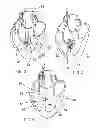 Fig. 03 - IMPLANTABLE PRODUCT WITH IMPROVED AQUEOUS INTERFACE CHARACTERISTICS AND METHODS FOR MAKING AND USING THE SAME
