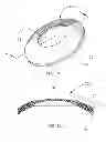Fig. 07 - IMPLANTABLE PRODUCT WITH IMPROVED AQUEOUS INTERFACE CHARACTERISTICS AND METHODS FOR MAKING AND USING THE SAME