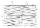 Fig. 01 - Stent with anti-migration features