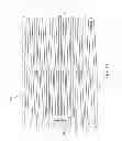 Fig. 06 - Stent with anti-migration features