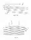 Fig. 19 - Stent with anti-migration features