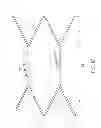 Fig. 33 - Stent with anti-migration features
