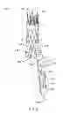 Fig. 07 - Endoluminal prosthesis with a valve arrangement