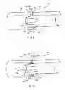 Fig. 08 - Endoluminal prosthesis with a valve arrangement
