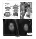 Fig. 06 - CROSSLINKED HYDROGELS AND METHODS OF MAKING AND USING THEREOF