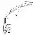 Fig. 01 - Methods of measuring heart valve annuluses for valve replacement