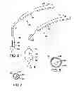 Fig. 03 - Methods of measuring heart valve annuluses for valve replacement