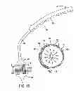 Fig. 07 - Methods of measuring heart valve annuluses for valve replacement