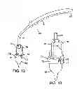 Fig. 08 - Methods of measuring heart valve annuluses for valve replacement