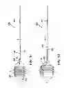 Fig. 12 - Methods of measuring heart valve annuluses for valve replacement