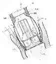 Fig. 01 - Prosthetic vascular conduit and assembly method