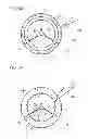 Fig. 09 - Prosthetic vascular conduit and assembly method