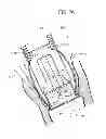 Fig. 11 - Prosthetic vascular conduit and assembly method