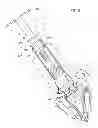 Fig. 12 - Prosthetic vascular conduit and assembly method